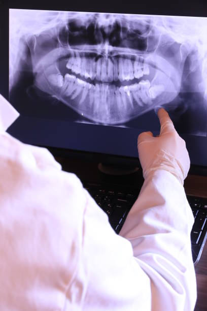 Best Urgent Care for Lost Fillings or Crowns in Lino Lakes, MN