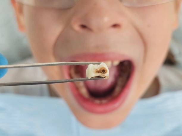 Best Same-Day Emergency Dental Services in Lino Lakes, MN